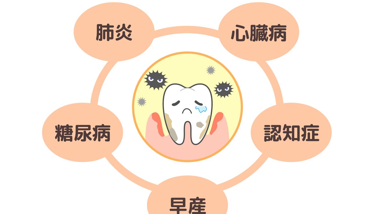 歯周病